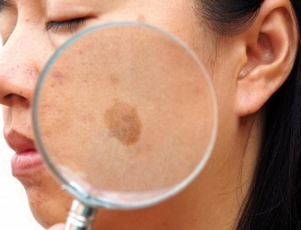 Lão hóa da là gì? Bí quyết chăm da tươi trẻ mà bạn không nên bỏ qua